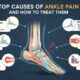 Top Causes of Ankle Pain and How to Treat Them