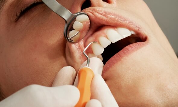 9 Common Oral Health Issues That Should Never Be Ignored