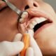 9 Common Oral Health Issues That Should Never Be Ignored